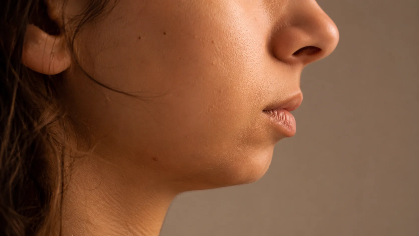Mentón retrognatico — zona de tratamiento en armonización facial, Spazio Barcelona