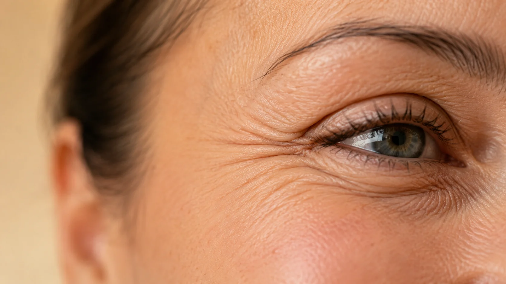 Patas de gallo — arrugas alrededor del ojo, zona de tratamiento con botox en Spazio Barcelona