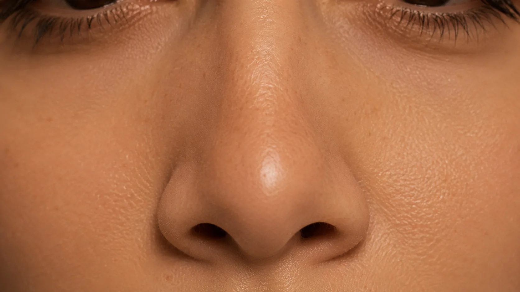 Asimetría nasal — corrección con rinomodelación en Spazio Barcelona