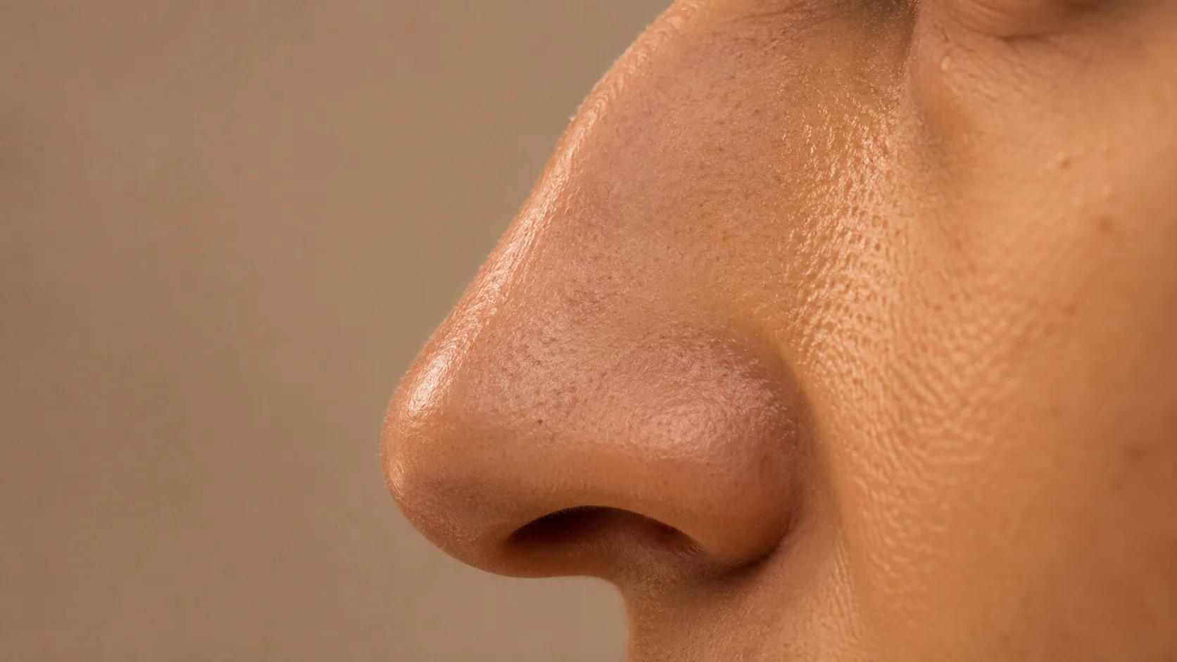 Caballete nasal — corrección con rinomodelación en Spazio Barcelona