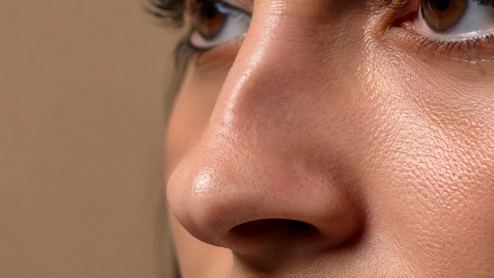 Post-rinoplastia — corrección con rinomodelación en Spazio Barcelona